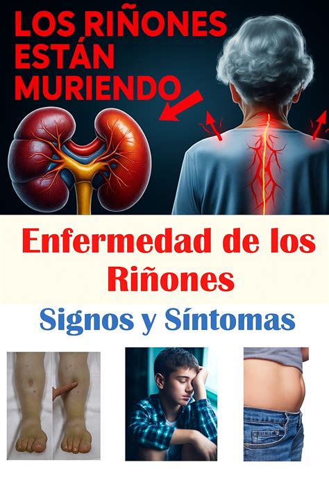 Señales de advertencia de enfermedad renal
